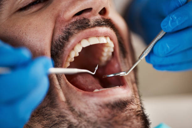 Best Mobile Emergency Dentist in Washington, IL